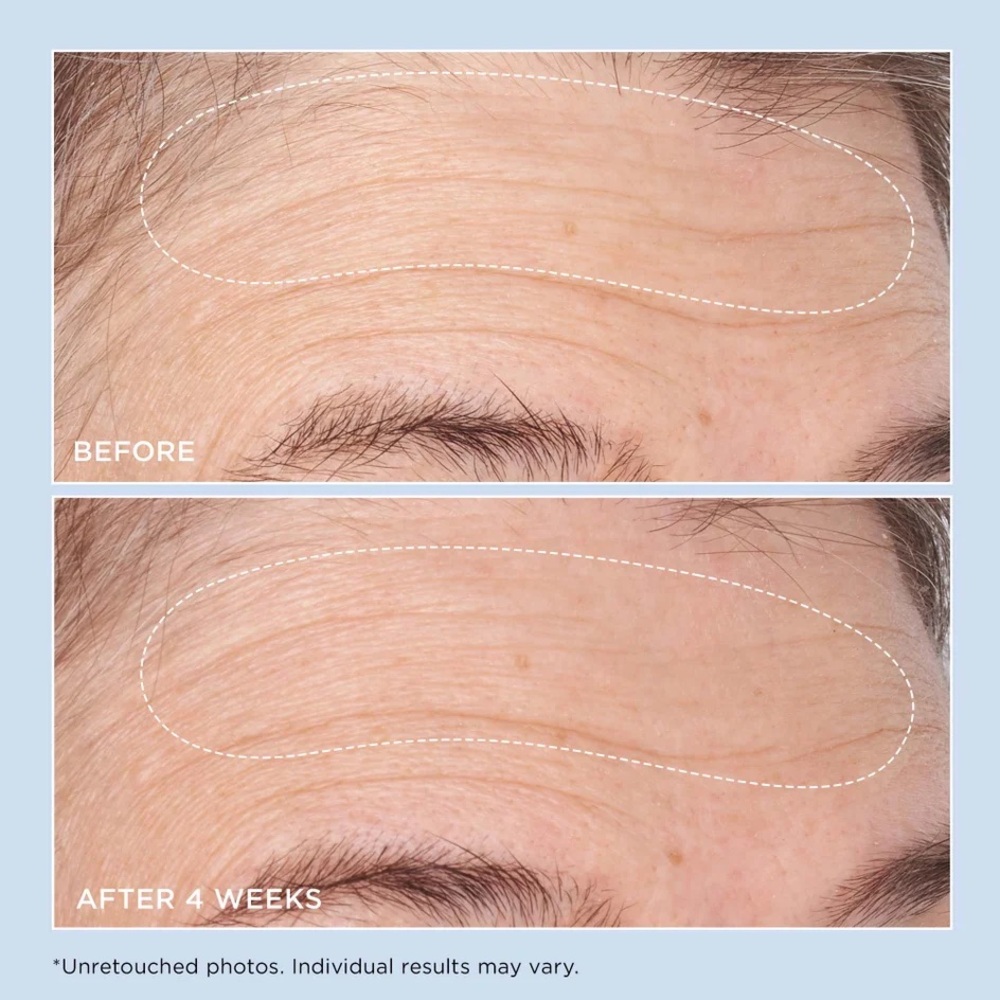 Perricone MD Cold Plasma Plus+ ADVANCED HYDRATING COMPLEX Just Out! F/S 2 Oz NIB - Picture 3 of 11